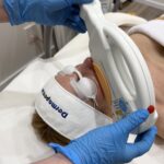 IPL redness reduction