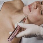 woman-microneedling-treatment